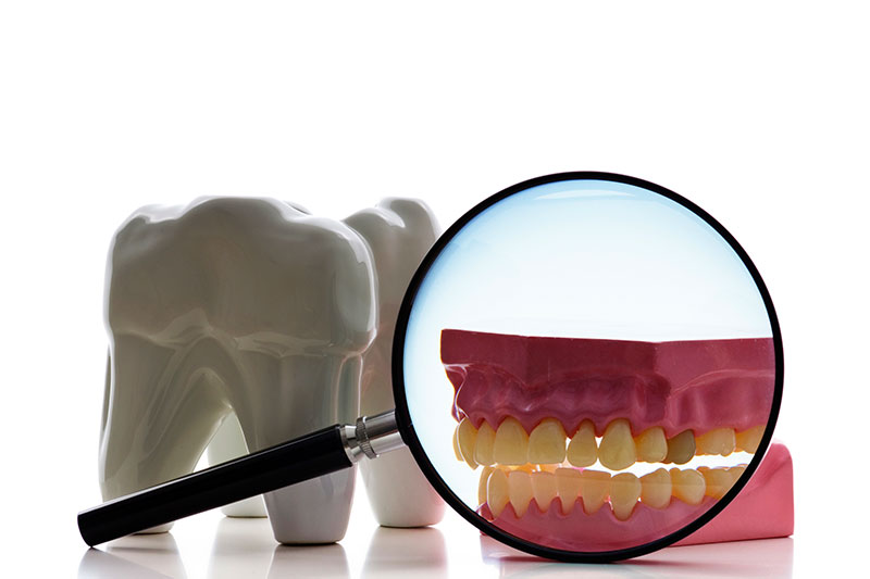 Root Canal in Milford